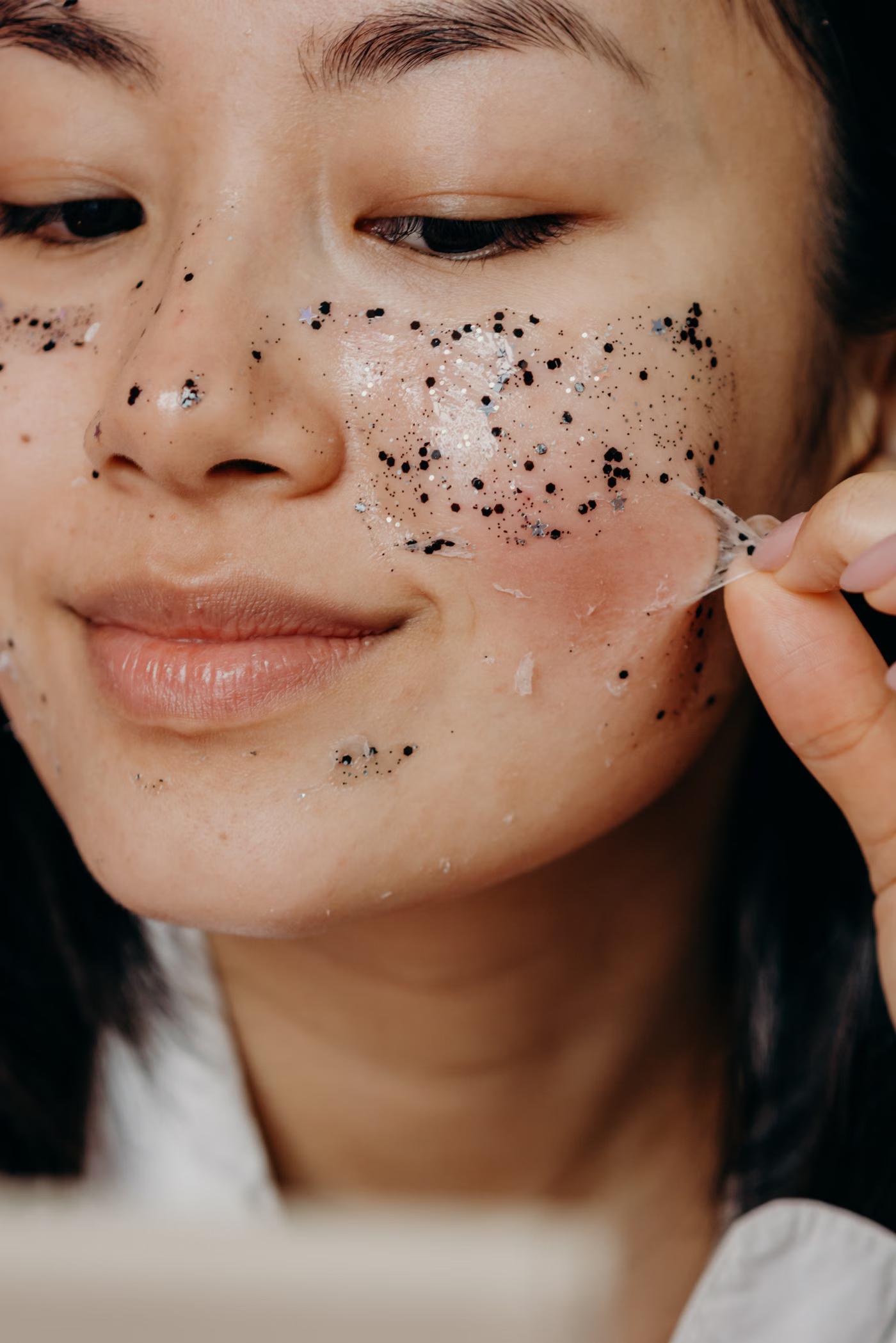 Chemical Peels: who it's for