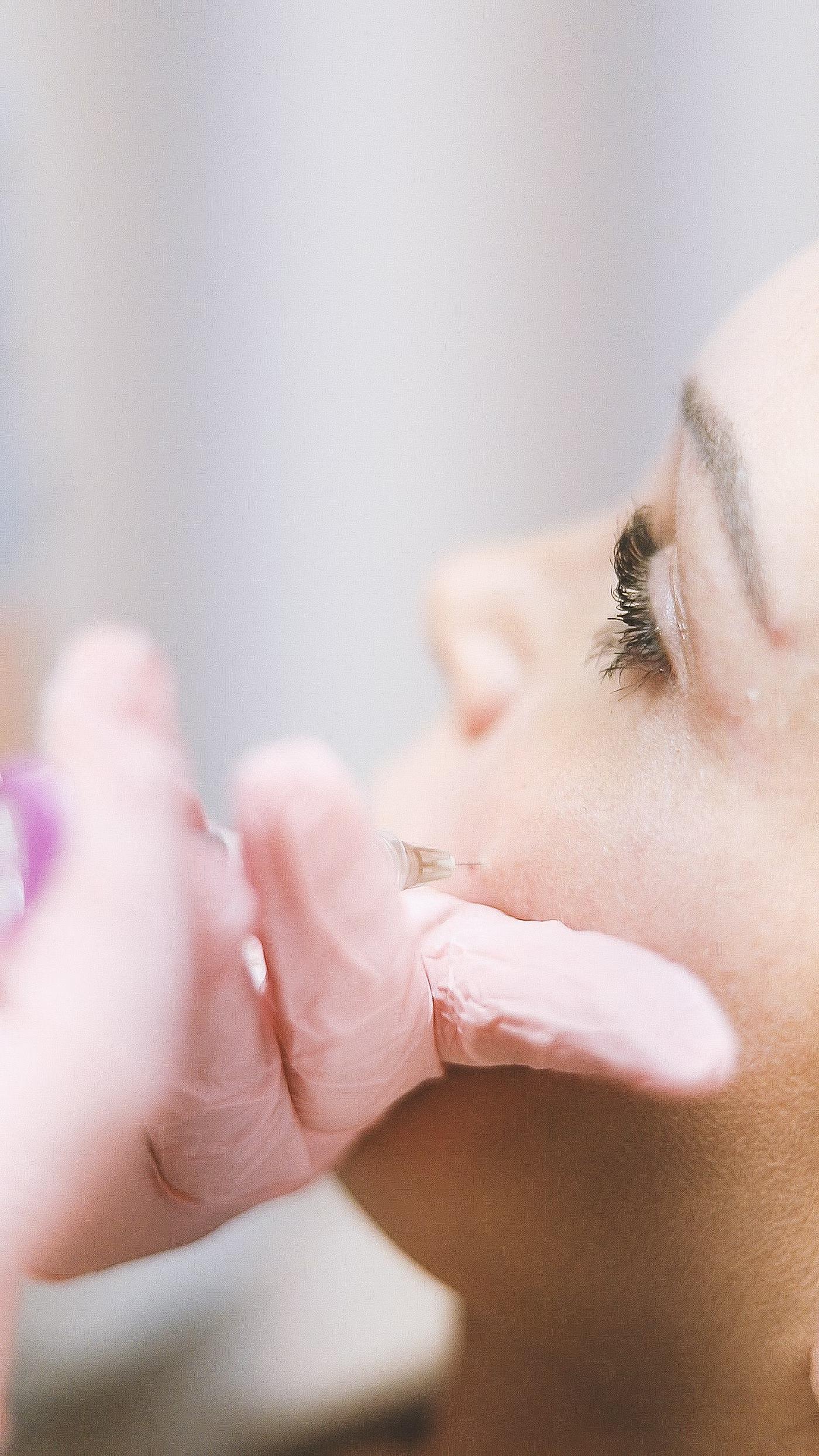 Dermal Fillers: what it addresses