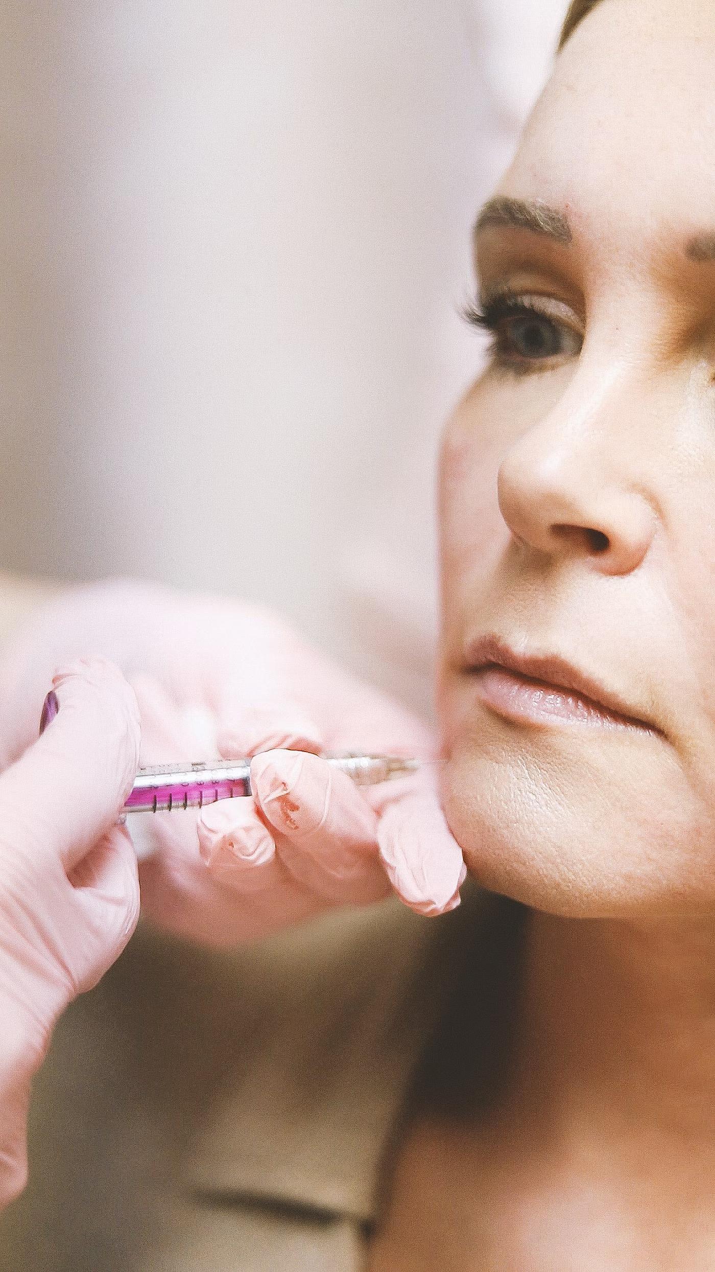 Dermal Fillers: who it's for