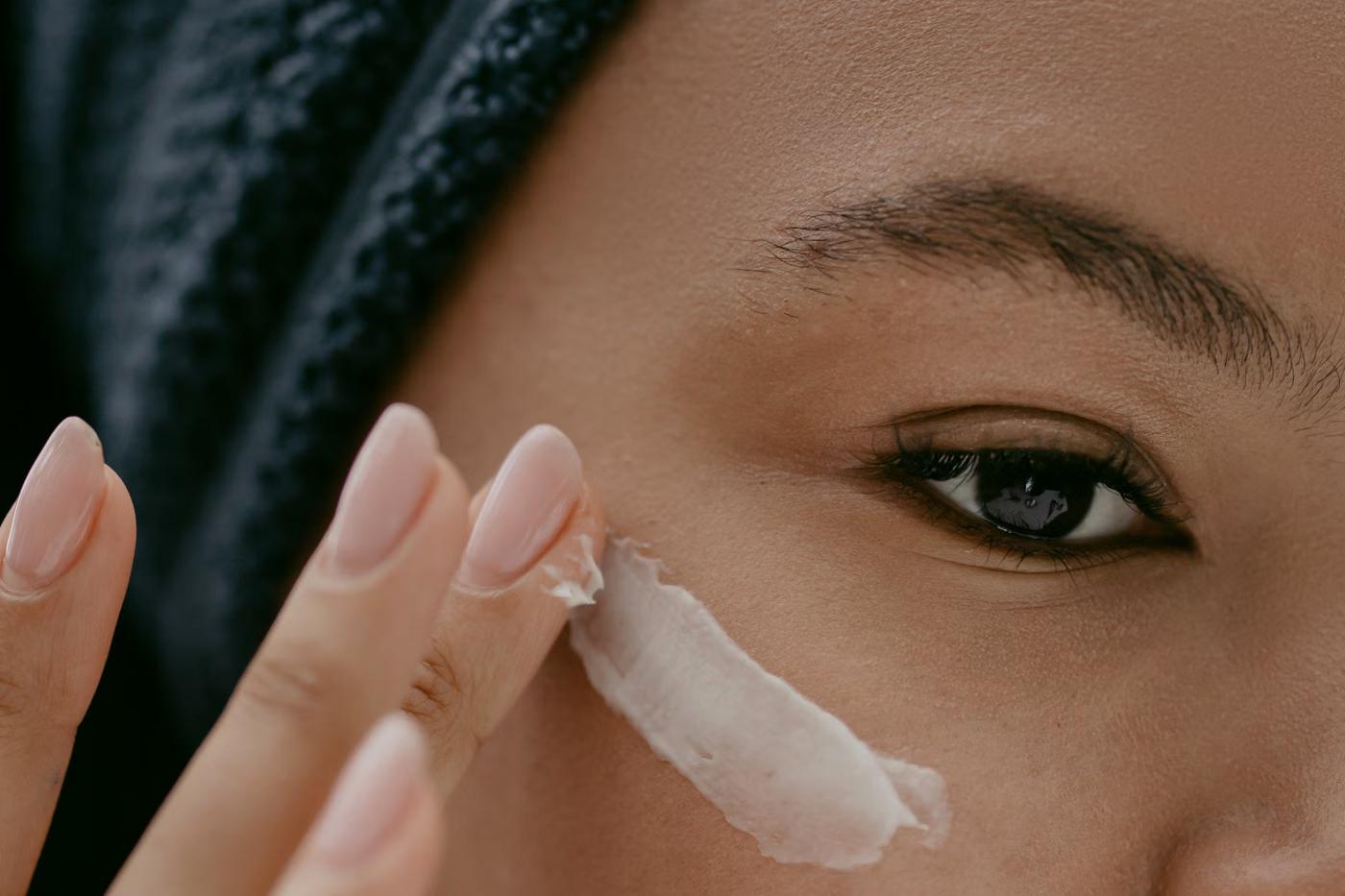 Melasma Treatment: who it's for
