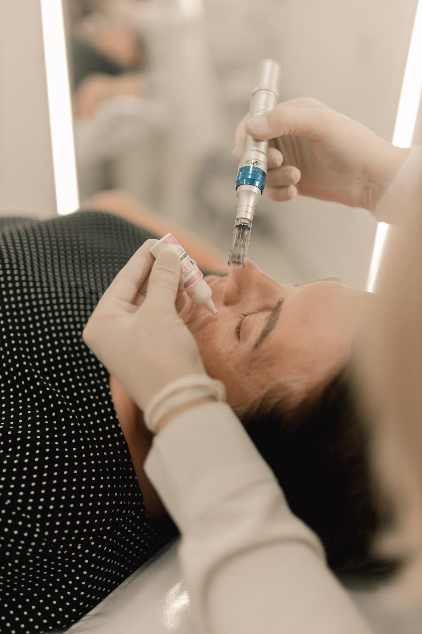 Microneedling: who it's for