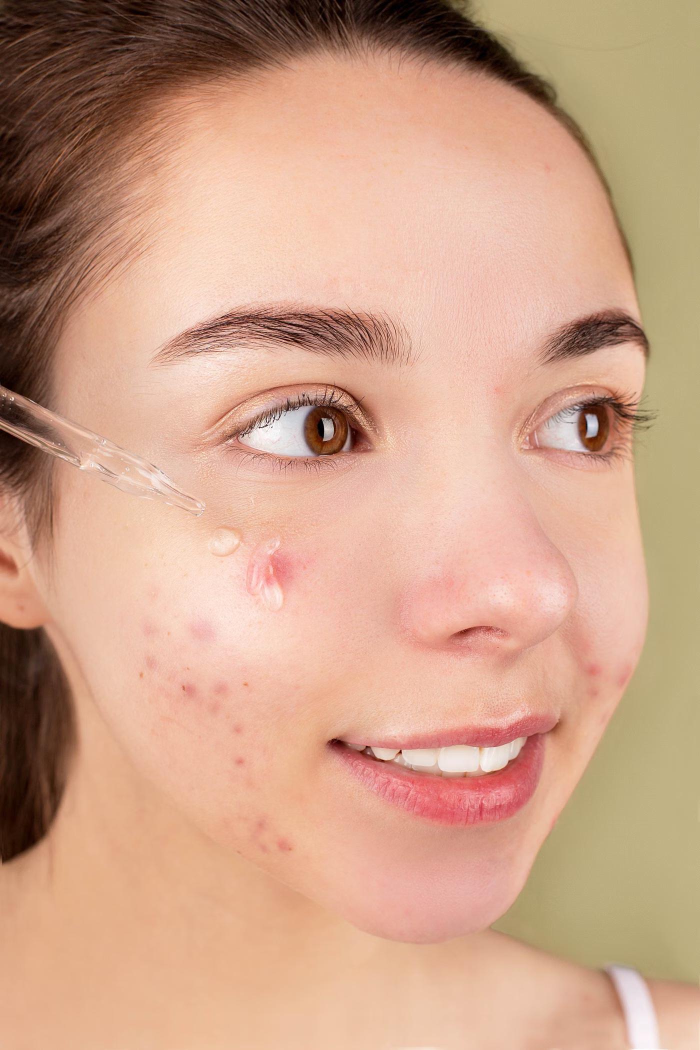 Skin Boosters: what it addresses