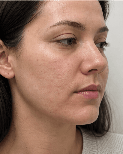 Oral Retinoid Programme: after