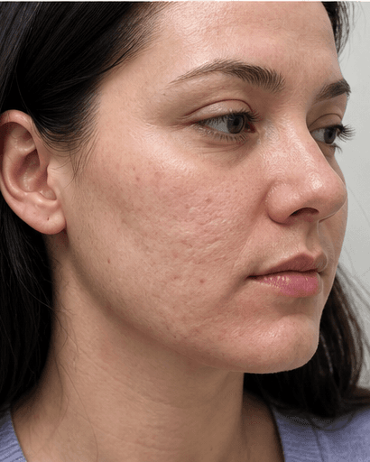 Oral Retinoid Programme: before