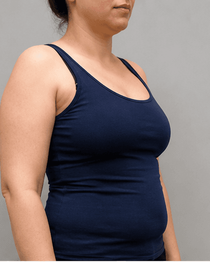 Ultrasonic Cavitation: after