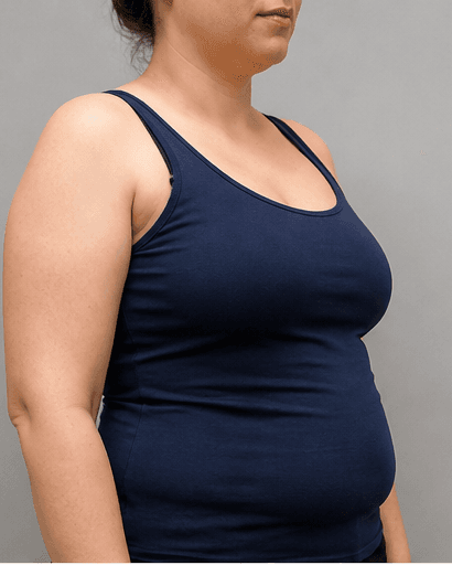 Ultrasonic Cavitation: before