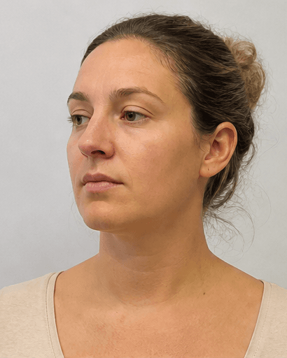 Post-Pregnancy Programme: before