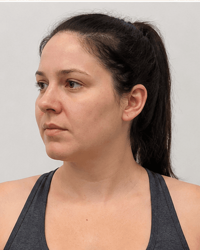 Post-Pregnancy Programme: before