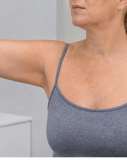 Body Skin Tightening: after