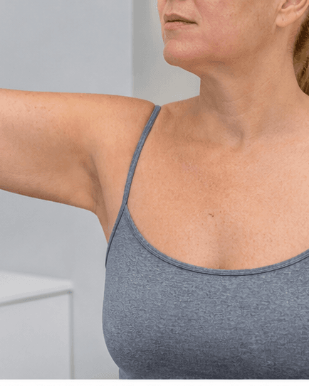 Body Skin Tightening: before