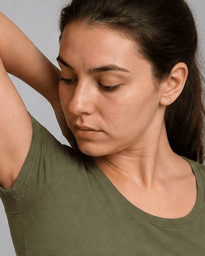 Underarm Sweat Treatment: after