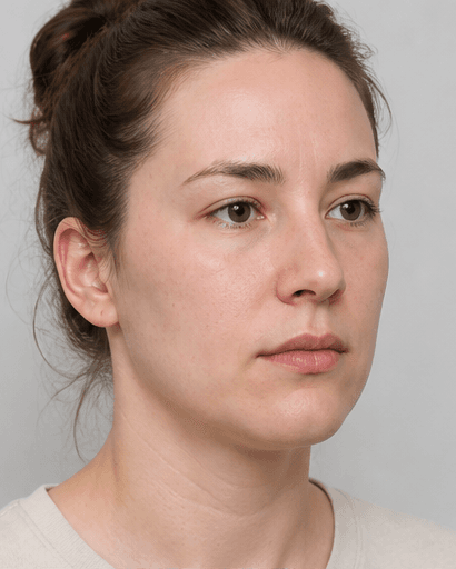 Jaw Slimming (Masseter): after
