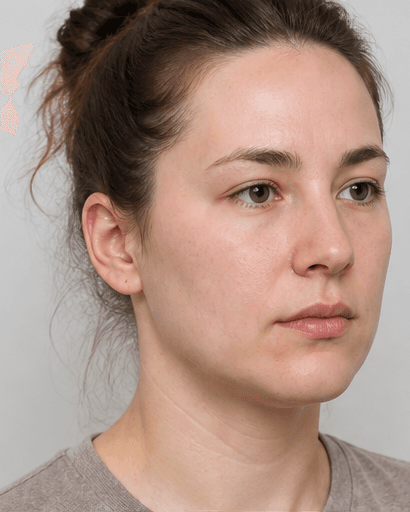 Jaw Slimming (Masseter): before