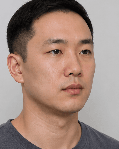 Jaw Slimming (Masseter): after