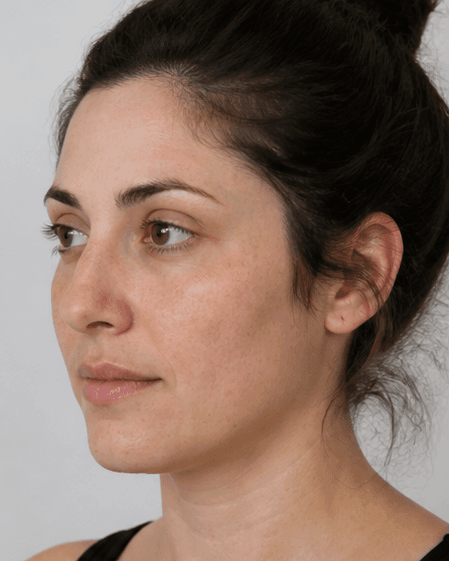 Bridal Body Prep: after