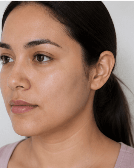 Pre-Event Glow Facial: after