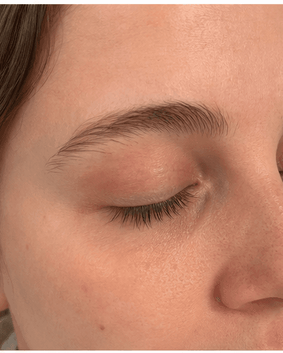 Brow Lamination: before