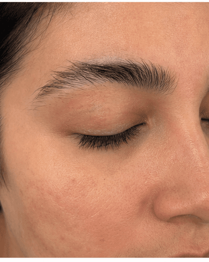 Brow Lamination: before