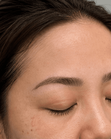 Brow Shape Mapping: after
