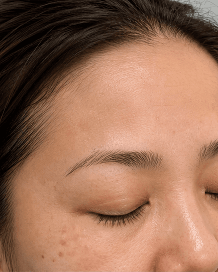 Brow Shape Mapping: before