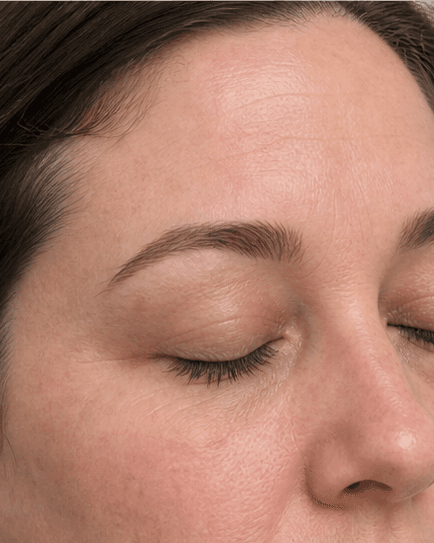 Brow Shape Mapping: after