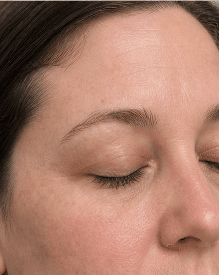 Brow Shape Mapping: before