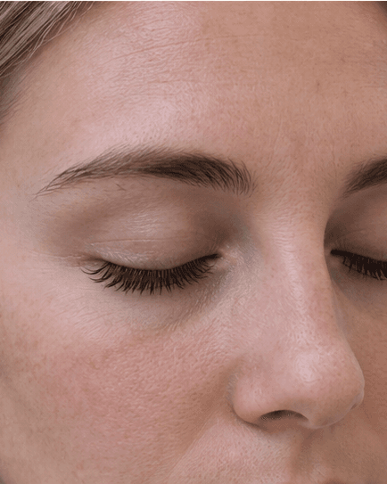 Lash Extensions: after
