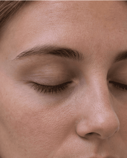 Lash Extensions: before