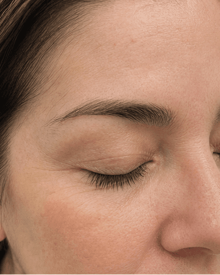 Lash Line Health Review: after