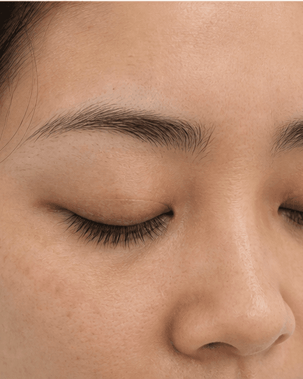 Lash Line Health Review: after