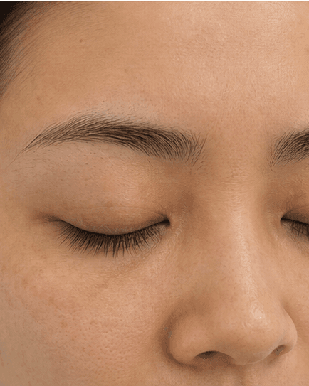 Lash Line Health Review: before
