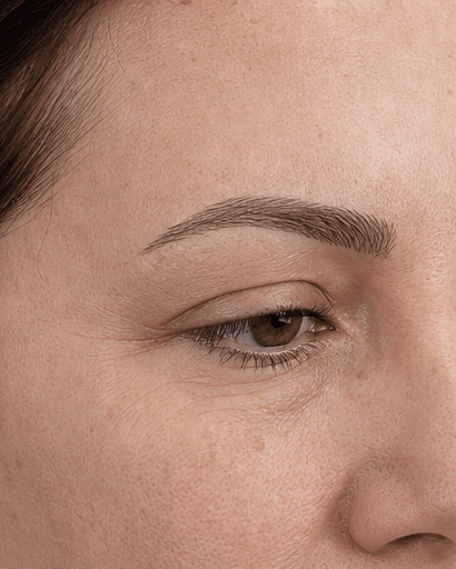 Microblading: after