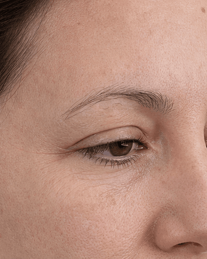 Microblading: before