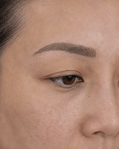 Microblading: after