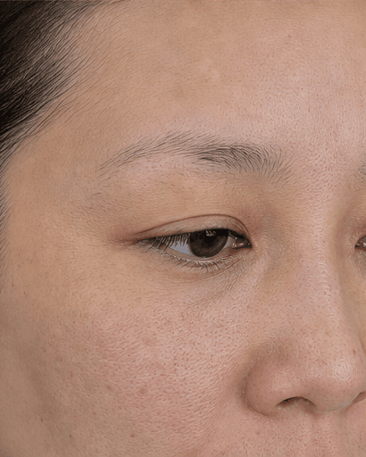 Microblading: before