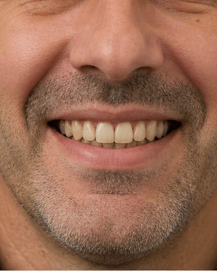 Smile Design Consult: before