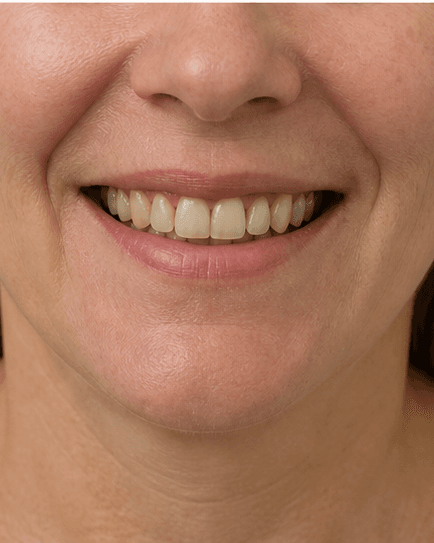 Smile Design Consult: before