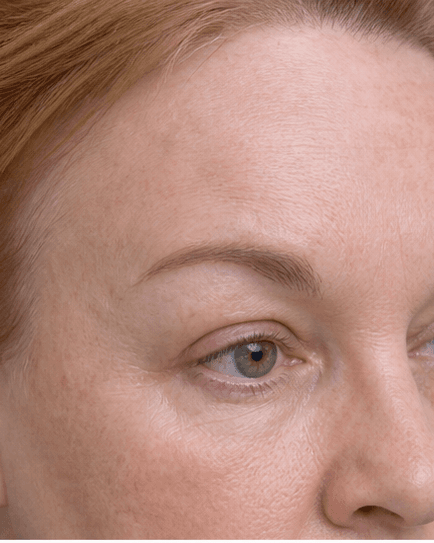 Chemical Brow Lift: after