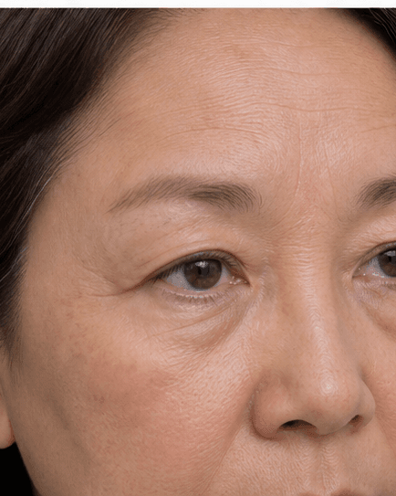 Chemical Brow Lift: before