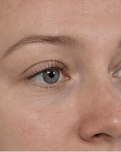 Lash Growth Therapy: after