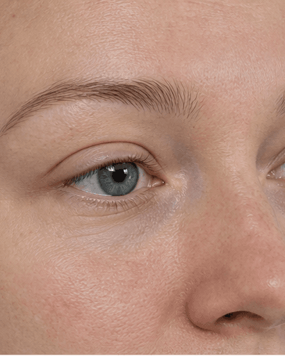 Lash Growth Therapy: before