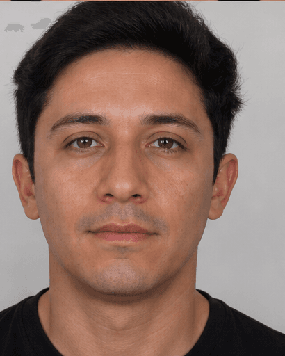 Facial Asymmetry Correction: after