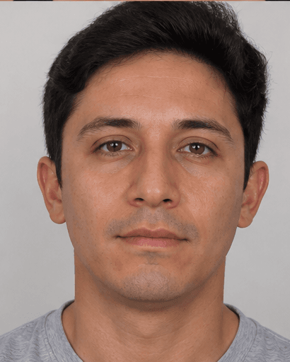 Facial Asymmetry Correction: before