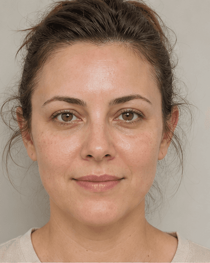 Enzyme Peel: after