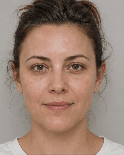 Enzyme Peel: before