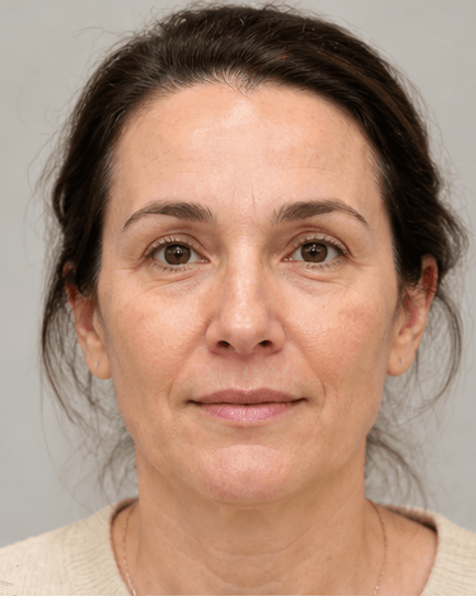 NCTF Mesotherapy: before
