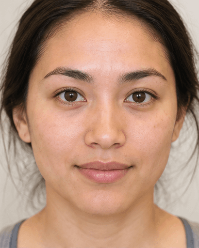 Oxygen Infusion Facial: before
