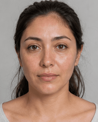 Skin Boosters: after