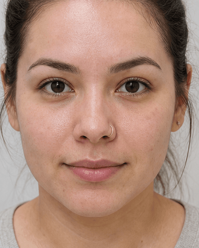 Ultrasonic Deep Cleanse: after