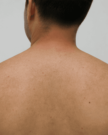 Back & Shoulders: after